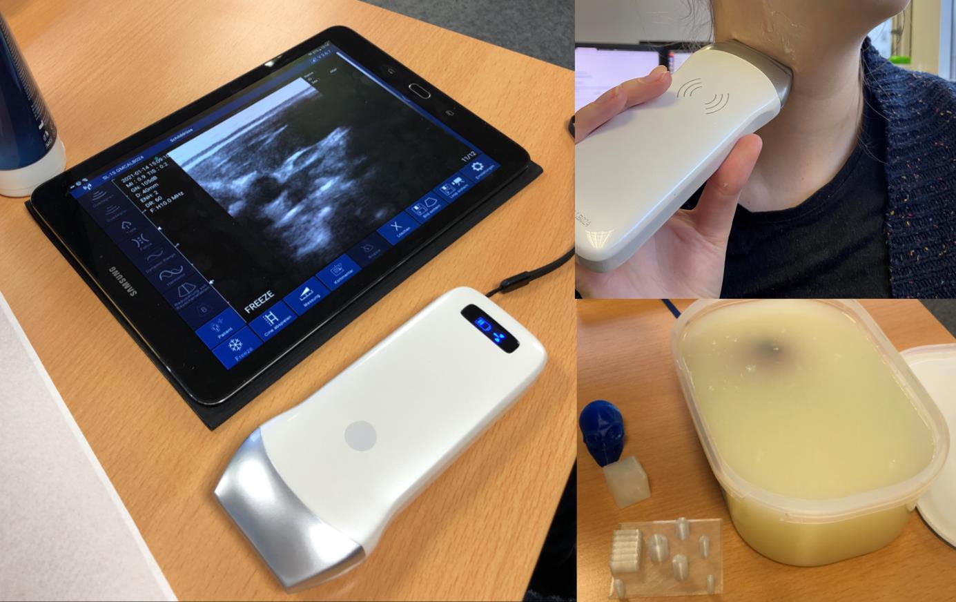 Clinical test acquisitions: fusion of a hyperspectral camera and a 3D scan from a time-of-flight camera