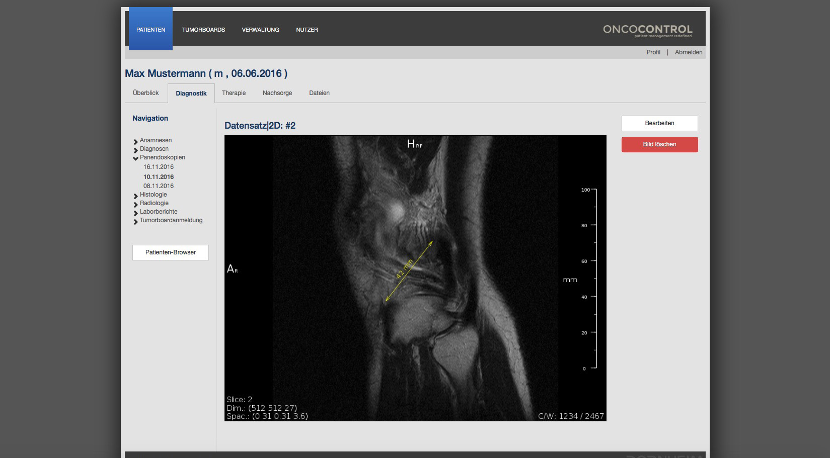 Interactive image reporting with measurement on an MRI cross-sectional image in the web browser