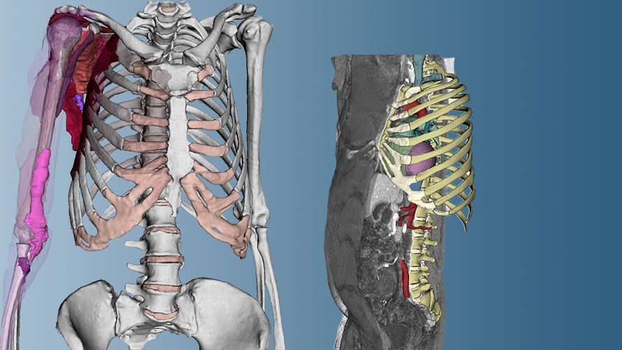 Dornheim Anatomy – Echte Anatomie in 3D auf Basis von CT- und MRT-Daten